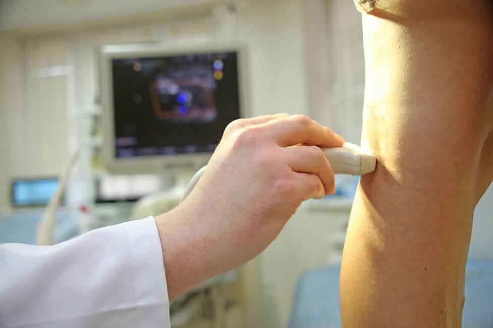 Ultrasound of the veins of the lower ends