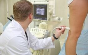 Methods for the treatment of varicose veins on the legs in women